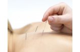 acupuntura cervical