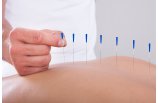 acupuntura en la columna