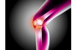 artrosis de rodilla